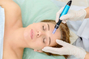 MICRONEEDLING